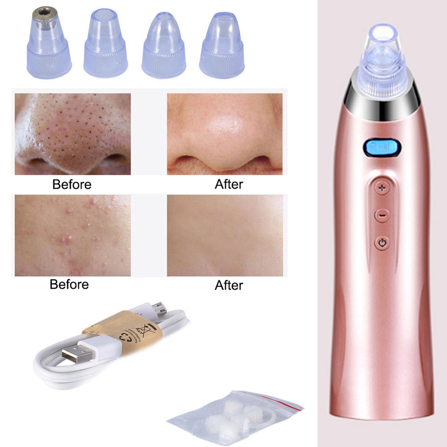 ClearSkin Pro: USB Rechargeable Blackhead Vacuum Extractor for Effortless Pore Cleansing